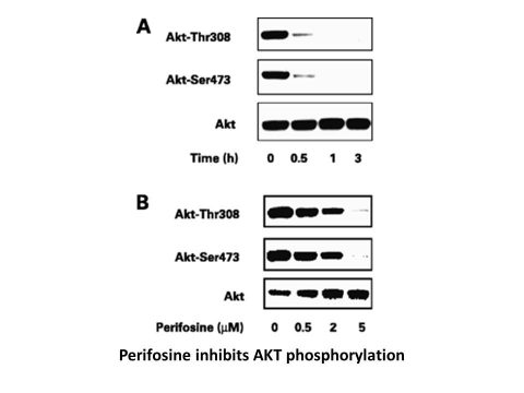 Perifosine (KRX-0401)