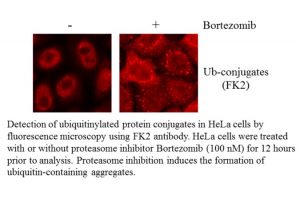 Bortezomib (PS-341)