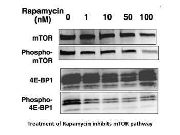 Rapamycin (Sirolimus)