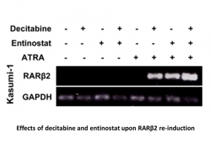 Entinostat (MS-275)