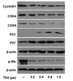 Trichostatin A (TSA)