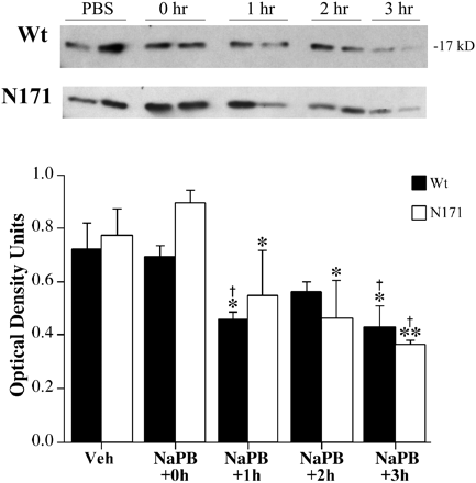 Sodium Phenylbutyrate	