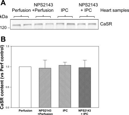 NPS-2143