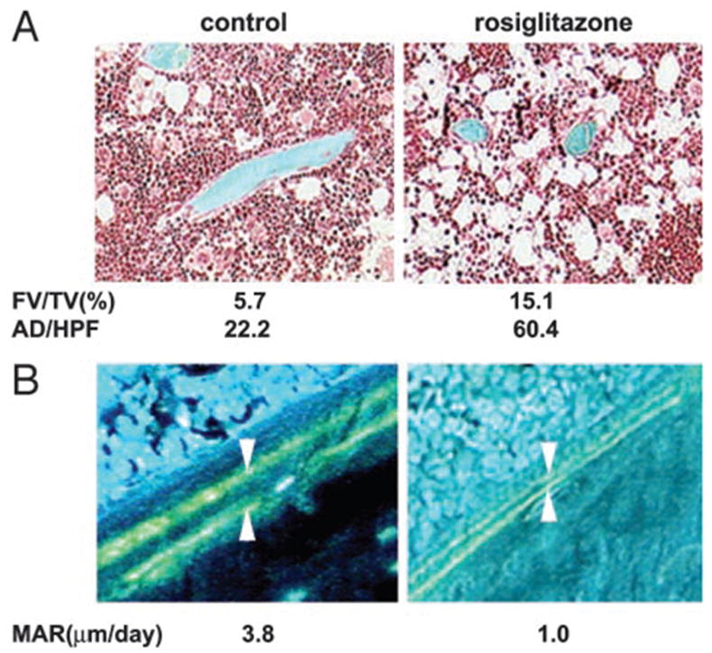 Rosiglitazone maleate