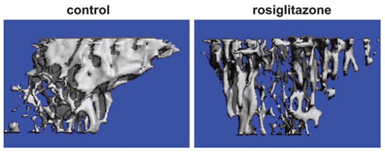 Rosiglitazone