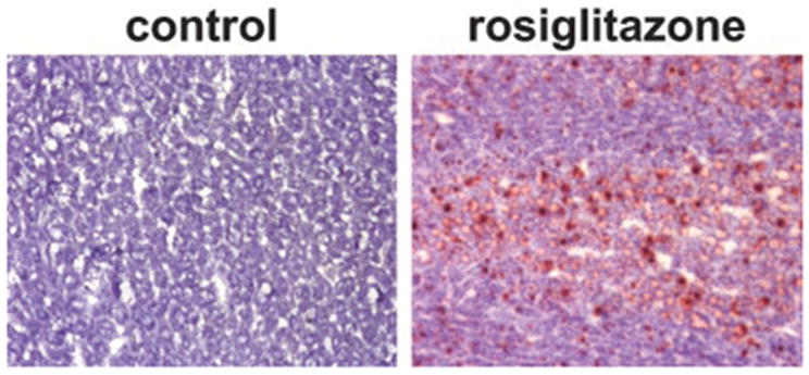 Rosiglitazone maleate