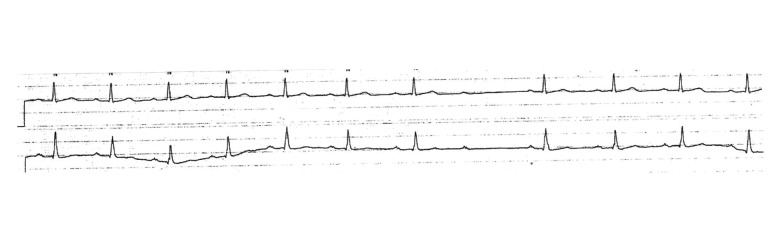 Trazodone HCl