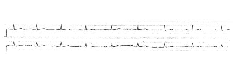 Trazodone HCl