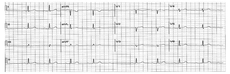 Trazodone HCl