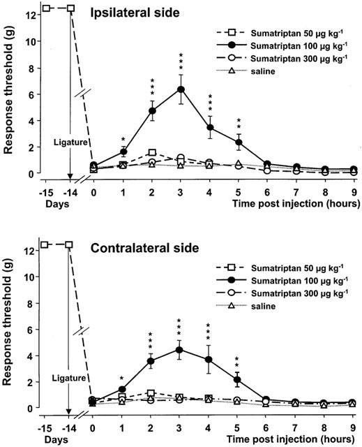 Sumatriptan Succinate