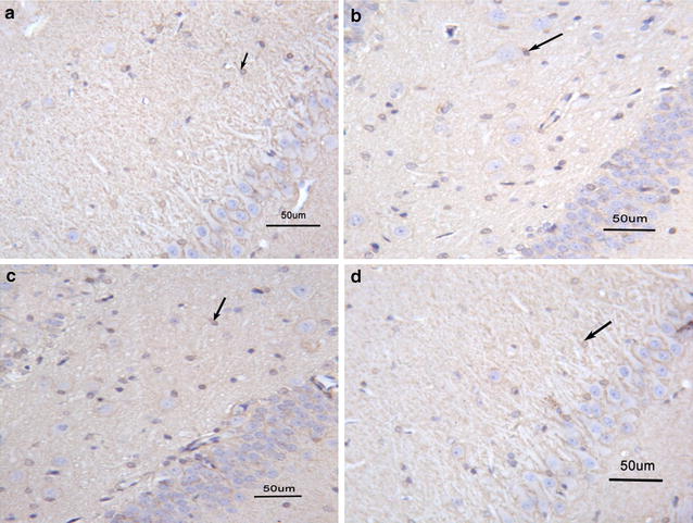 Venlafaxine