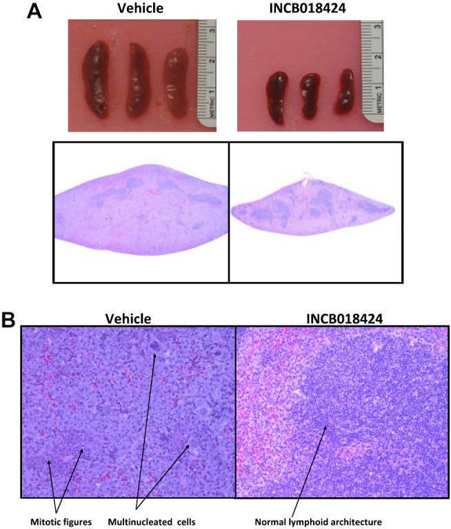 S-Ruxolitinib (INCB018424)