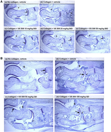 Decernotinib (VX-509)