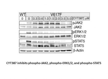 Momelotinib (CYT387)