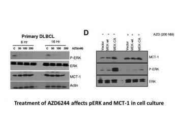 Selumetinib (AZD6244)