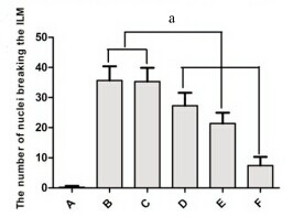 Sorafenib free base