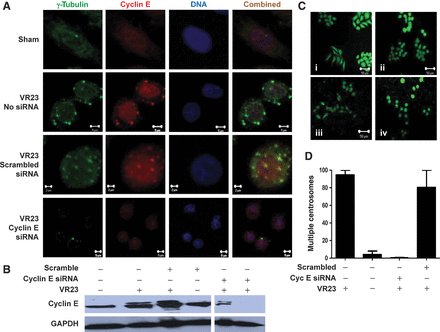 VR23 RELATED PROTEASOME PRODUCTS