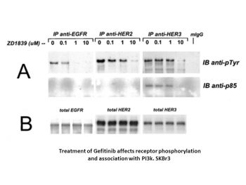 Gefitinib (ZD1839)