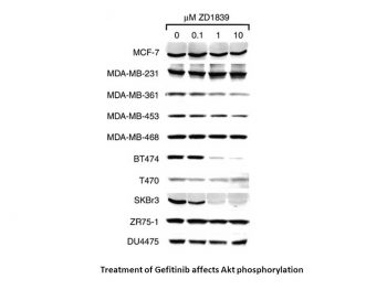 Gefitinib (ZD1839)