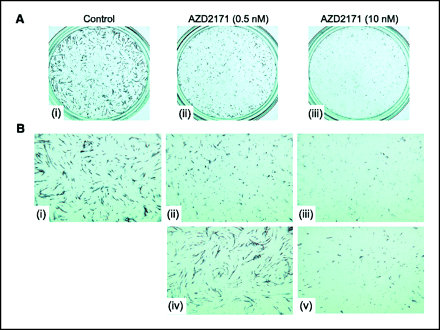 Cediranib (AZD2171)