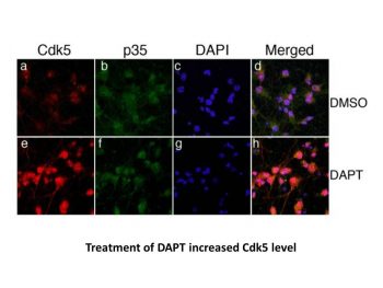 DAPT (GSI-IX)