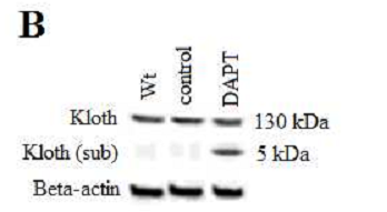 DAPT (GSI-IX)