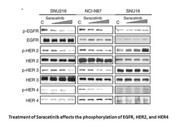 Saracatinib (AZD0530)