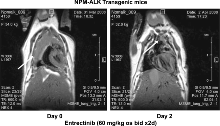 Entrectinib 