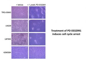 Palbociclib