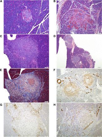 Fenebrutinib (GDC-0853)  