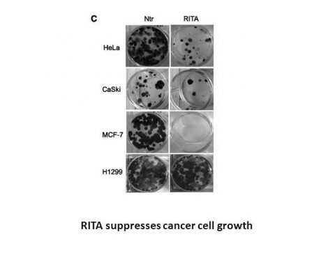 RITA (NSC 652287)