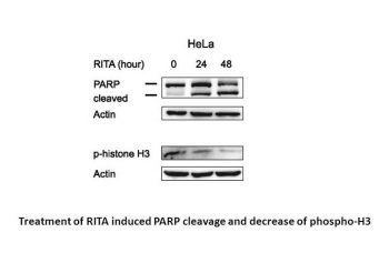 RITA (NSC 652287)